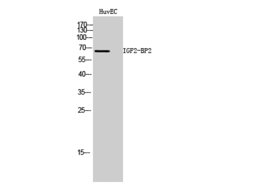 Western Blot - Anti-IGF2BP2 Antibody (C20808) - Antibodies.com