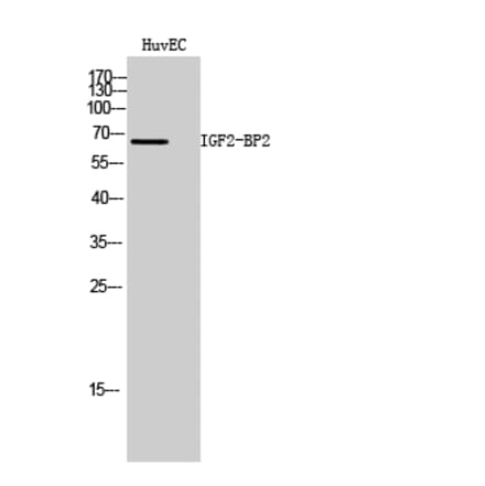 Western Blot - Anti-IGF2BP2 Antibody (C20808) - Antibodies.com