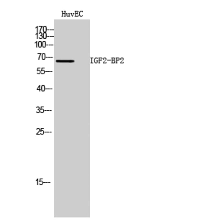 Western Blot - Anti-IGF2BP2 Antibody (C20808) - Antibodies.com