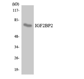 Western Blot - Anti-IGF2BP2 Antibody (R12-2912) - Antibodies.com