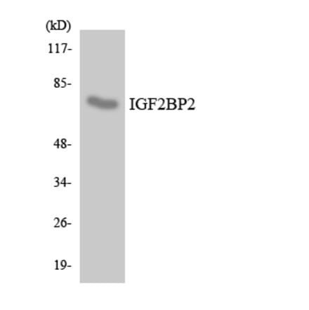 Western Blot - Anti-IGF2BP2 Antibody (R12-2912) - Antibodies.com