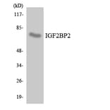 Western Blot - Anti-IGF2BP2 Antibody (R12-2912) - Antibodies.com