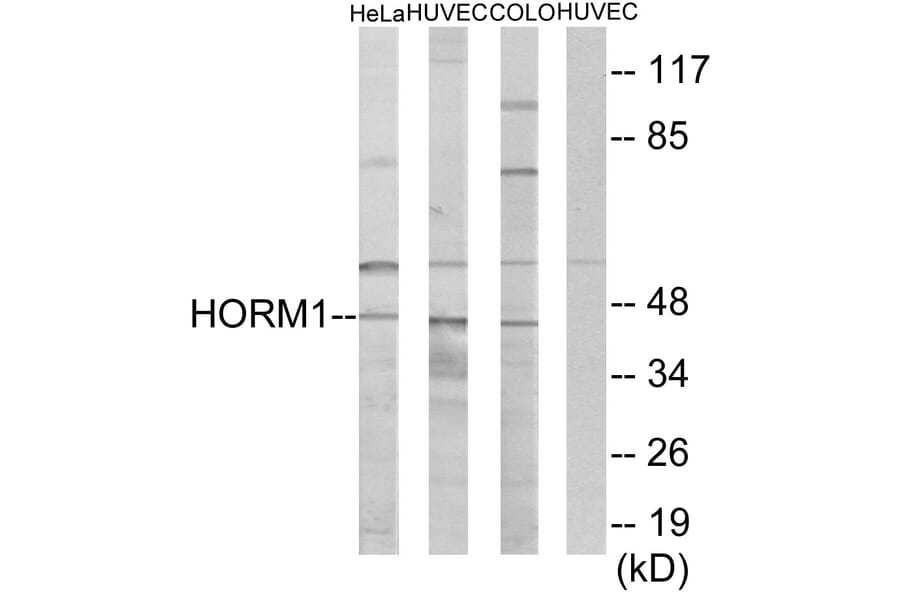 Western Blot - Anti-HORMAD1 Antibody (C11285) - Antibodies.com