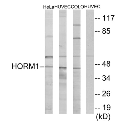 Western Blot - Anti-HORMAD1 Antibody (C11285) - Antibodies.com