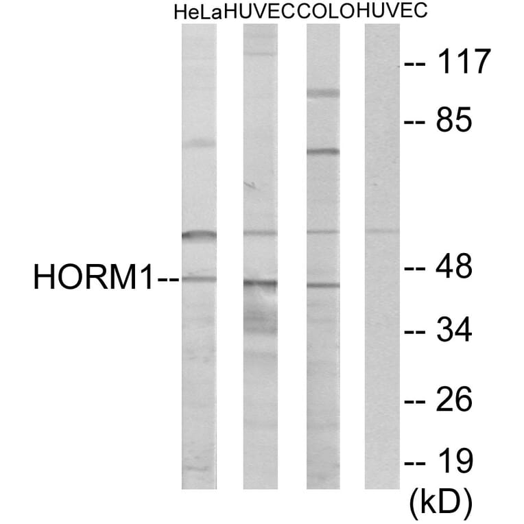 Western Blot - Anti-HORMAD1 Antibody (C11285) - Antibodies.com
