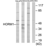 Western Blot - Anti-HORMAD1 Antibody (C11285) - Antibodies.com