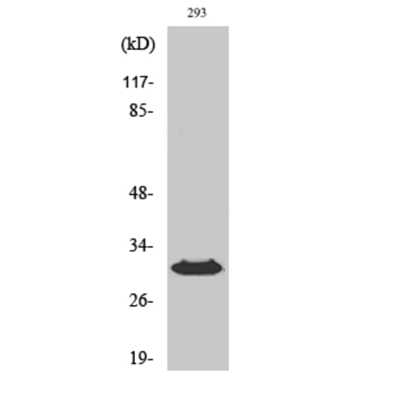 Western Blot - Anti-HLA-DOB Antibody (C16219) - Antibodies.com