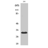 Western Blot - Anti-HLA-DOB Antibody (C16219) - Antibodies.com