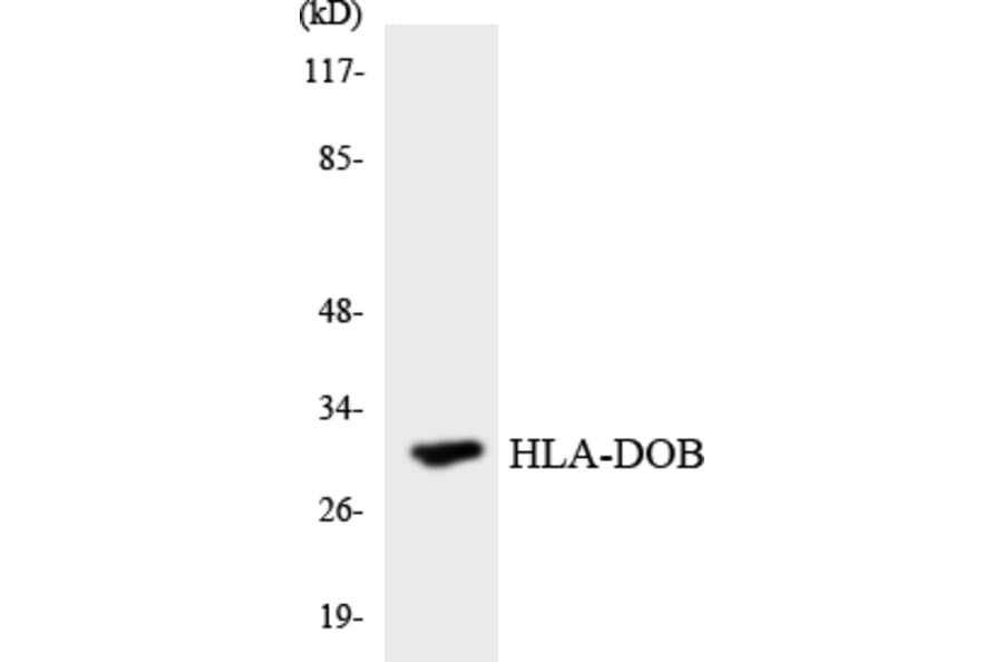 Western Blot - Anti-HLA-DOB Antibody (R12-2881) - Antibodies.com