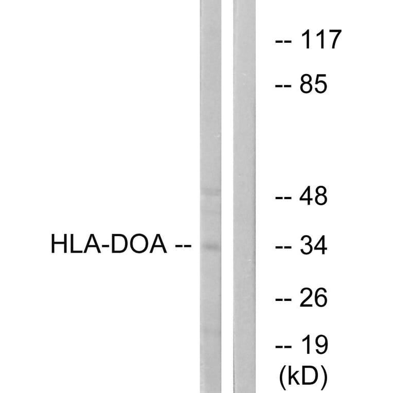 Western Blot - Anti-HLA-DOA Antibody (C16218) - Antibodies.com