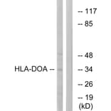 Western Blot - Anti-HLA-DOA Antibody (C16218) - Antibodies.com