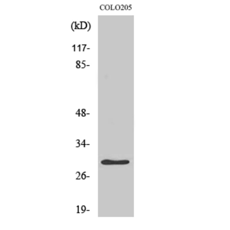 Western Blot - Anti-HLA-DOA Antibody (C16218) - Antibodies.com