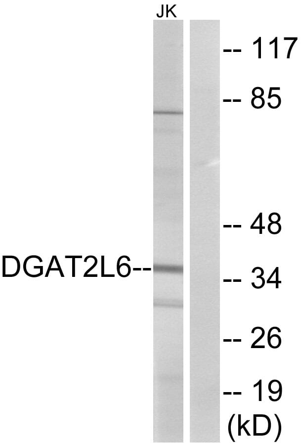 Western blot analysis of lysates from Jurkat cells using Anti-DGAT2L6 Antibody. The right hand lane represents a negative control, where the antibody is blocked by the immunising peptide.