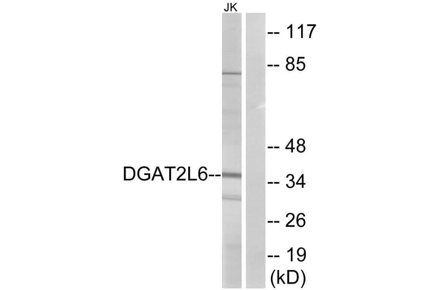 Western Blot - Anti-DGAT2L6 Antibody (C15350) - Antibodies.com