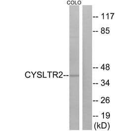 Western Blot - Anti-CYSLTR2 Antibody (G075) - Antibodies.com