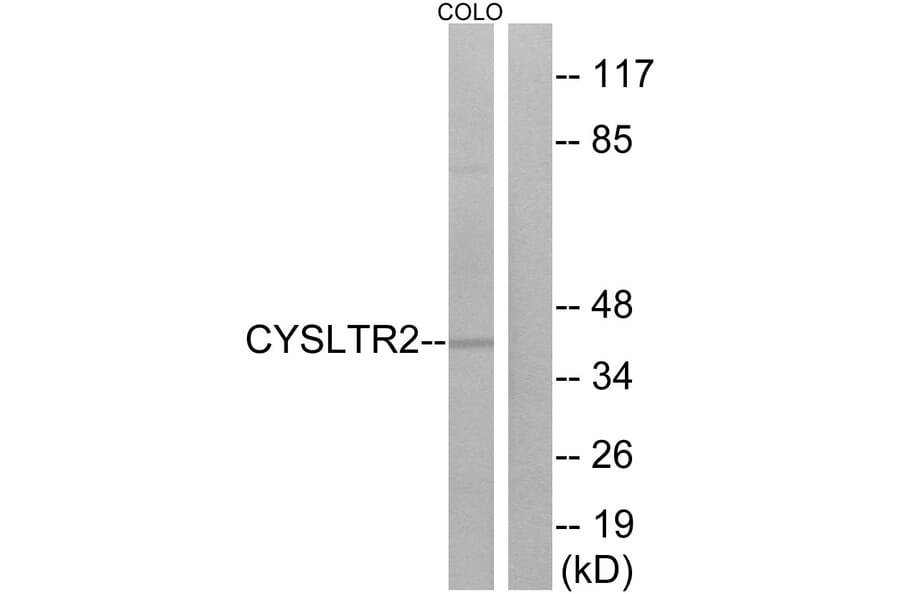 Western Blot - Anti-CYSLTR2 Antibody (G075) - Antibodies.com