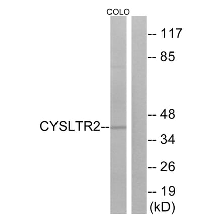 Western Blot - Anti-CYSLTR2 Antibody (G075) - Antibodies.com