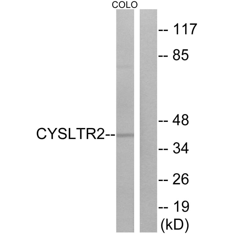 Western Blot - Anti-CYSLTR2 Antibody (G075) - Antibodies.com