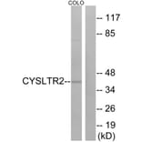 Western Blot - Anti-CYSLTR2 Antibody (G075) - Antibodies.com