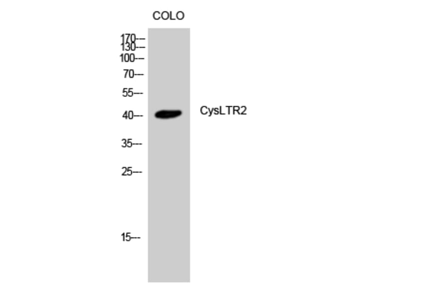 Western Blot - Anti-CYSLTR2 Antibody (G075) - Antibodies.com