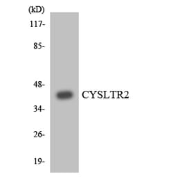 Western Blot - Anti-CYSLTR2 Antibody (R12-2669) - Antibodies.com