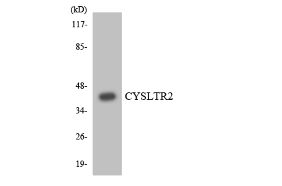 Western Blot - Anti-CYSLTR2 Antibody (R12-2669) - Antibodies.com