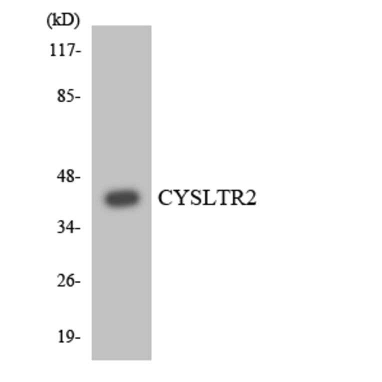 Western Blot - Anti-CYSLTR2 Antibody (R12-2669) - Antibodies.com