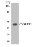 Western Blot - Anti-CYSLTR2 Antibody (R12-2669) - Antibodies.com