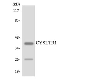 Western Blot - Anti-CYSLTR1 Antibody (R12-2668) - Antibodies.com