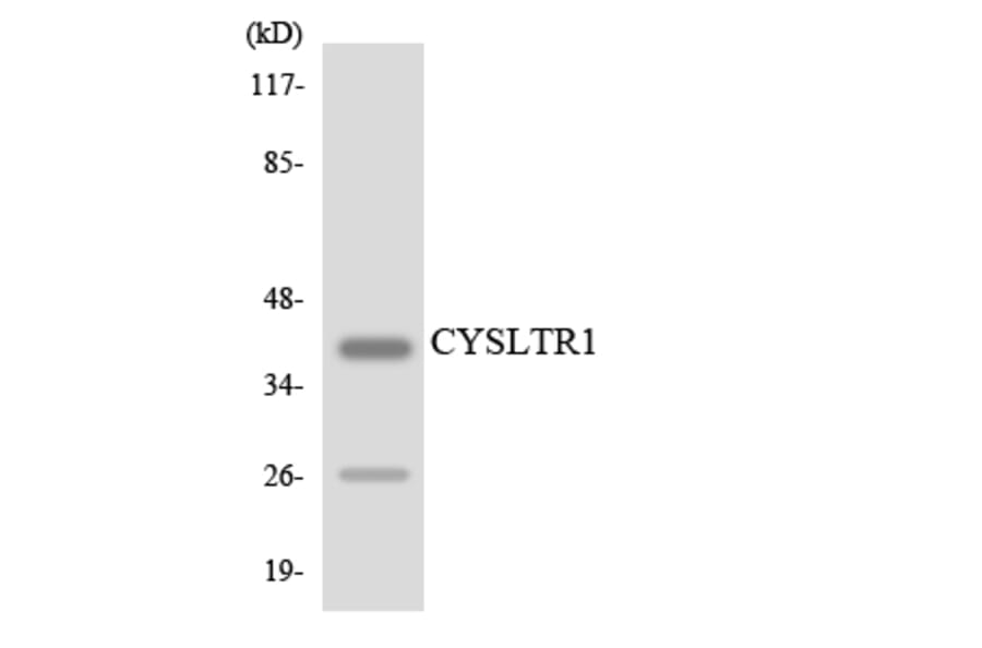 Western Blot - Anti-CYSLTR1 Antibody (R12-2668) - Antibodies.com