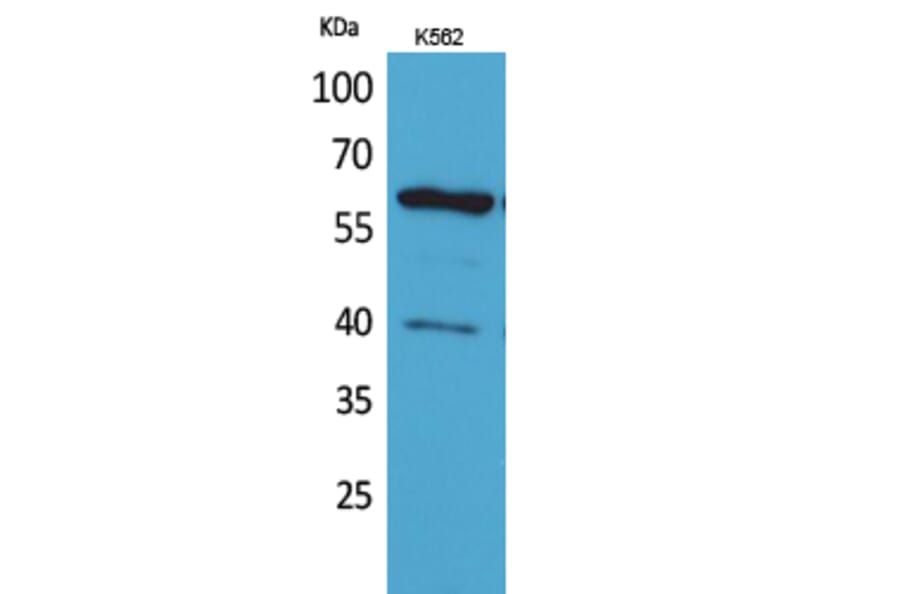 Western Blot - Anti-CYP11A1 Antibody (C30263) - Antibodies.com