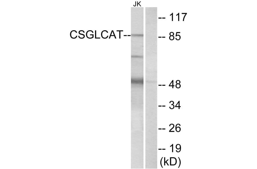 Western Blot - Anti-CSGLCAT Antibody (C15095) - Antibodies.com