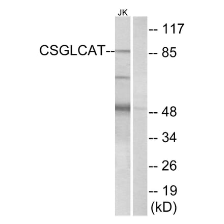 Western Blot - Anti-CSGLCAT Antibody (C15095) - Antibodies.com