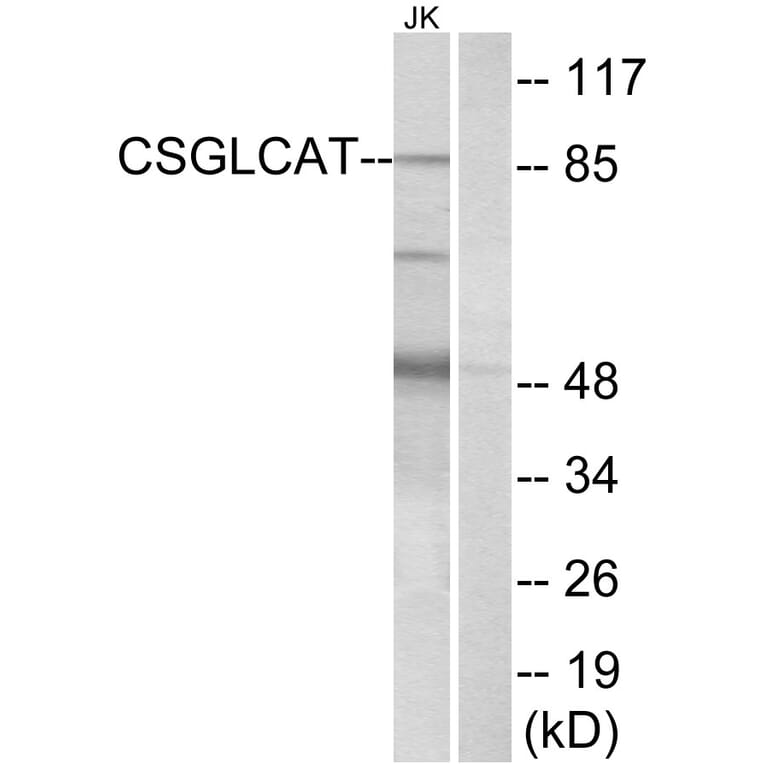 Western Blot - Anti-CSGLCAT Antibody (C15095) - Antibodies.com