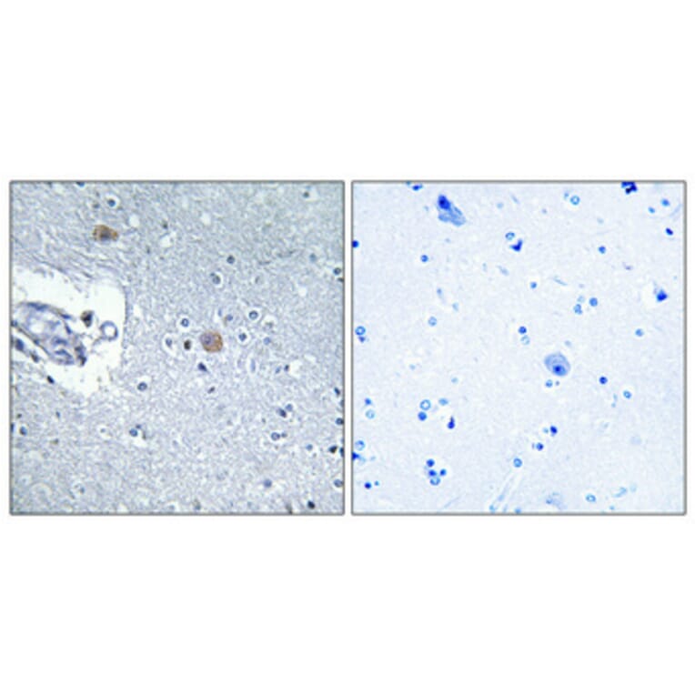 Immunohistochemistry - Anti-CSGLCAT Antibody (C15095) - Antibodies.com