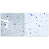 Immunohistochemistry - Anti-CSGLCAT Antibody (C15095) - Antibodies.com