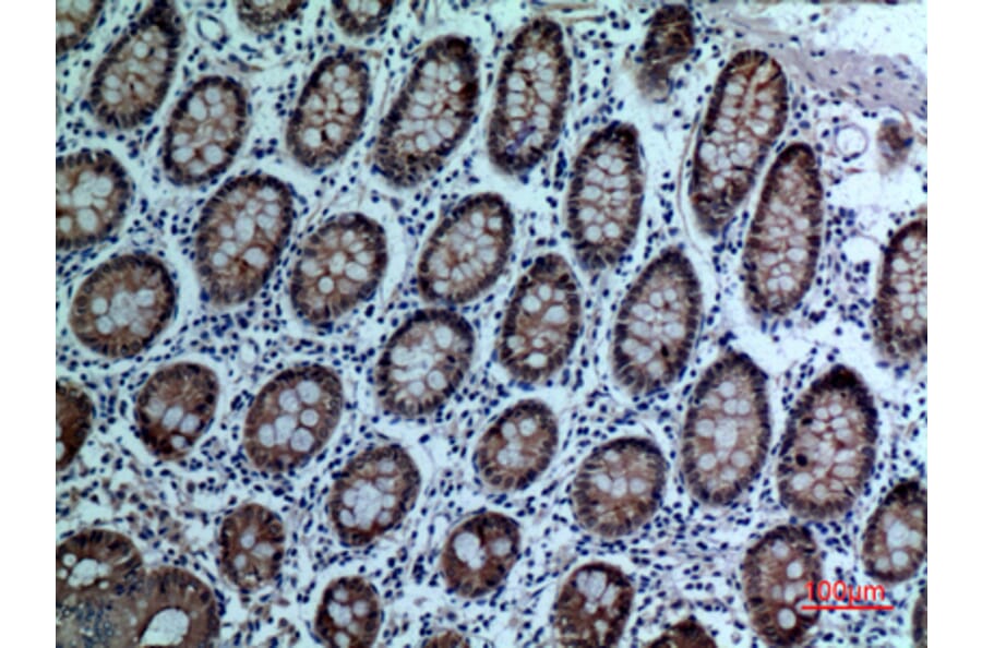 Immunohistochemistry - Anti-CEACAM5 Antibody (C30087) - Antibodies.com