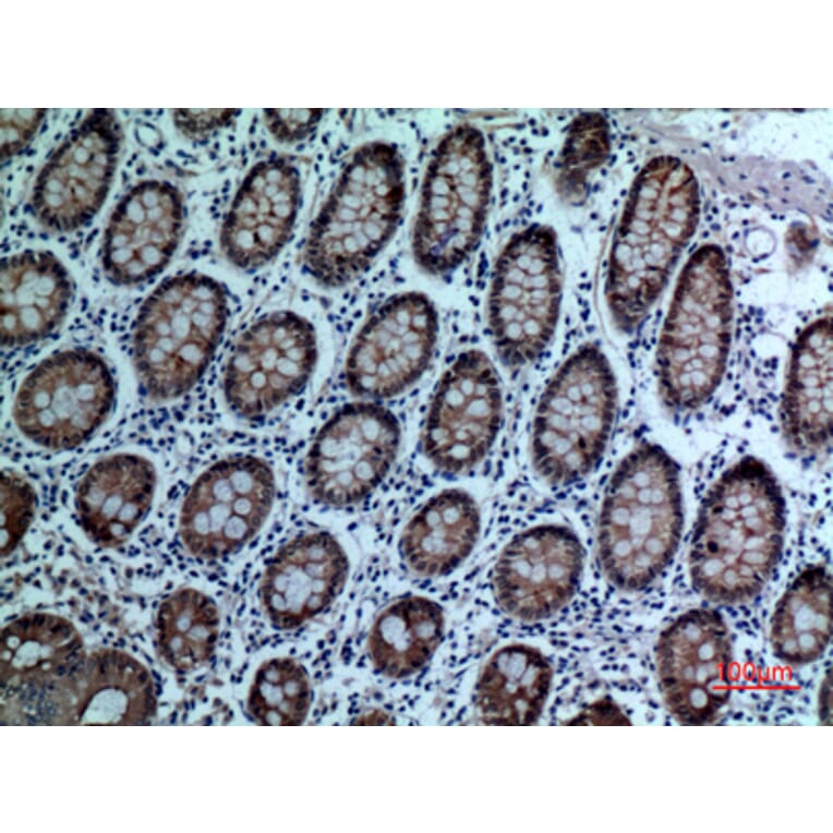 Immunohistochemistry - Anti-CEACAM5 Antibody (C30087) - Antibodies.com