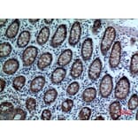 Immunohistochemistry - Anti-CEACAM5 Antibody (C30087) - Antibodies.com