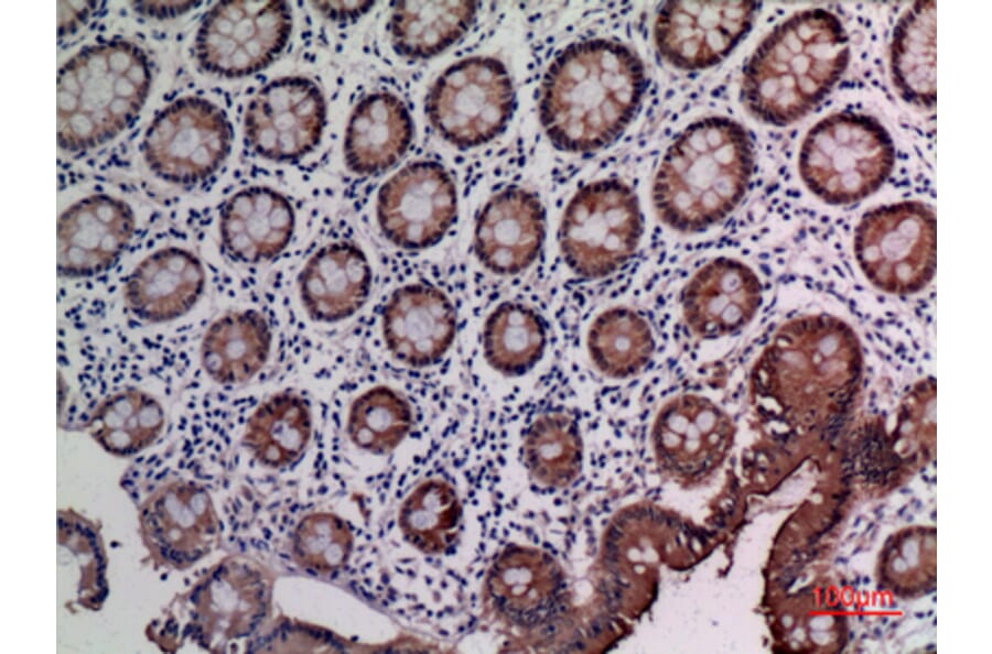 Immunohistochemistry - Anti-CEACAM5 Antibody (C30087) - Antibodies.com