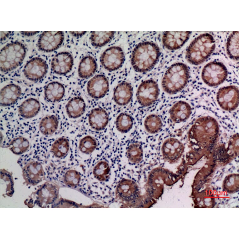 Immunohistochemistry - Anti-CEACAM5 Antibody (C30087) - Antibodies.com