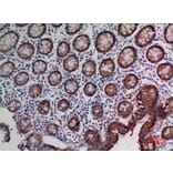 Immunohistochemistry - Anti-CEACAM5 Antibody (C30087) - Antibodies.com