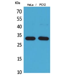 Western Blot - Anti-CD300LF Antibody (C30488) - Antibodies.com