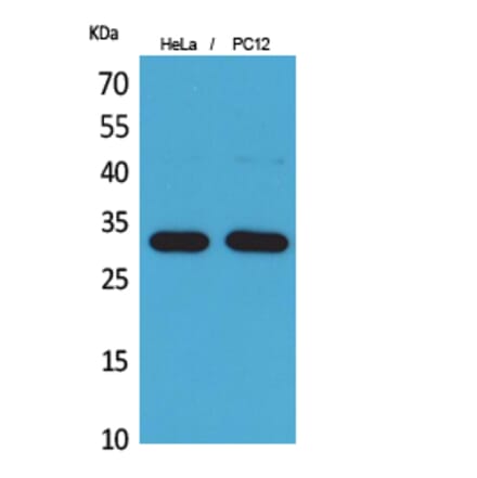 Western Blot - Anti-CD300LF Antibody (C30488) - Antibodies.com