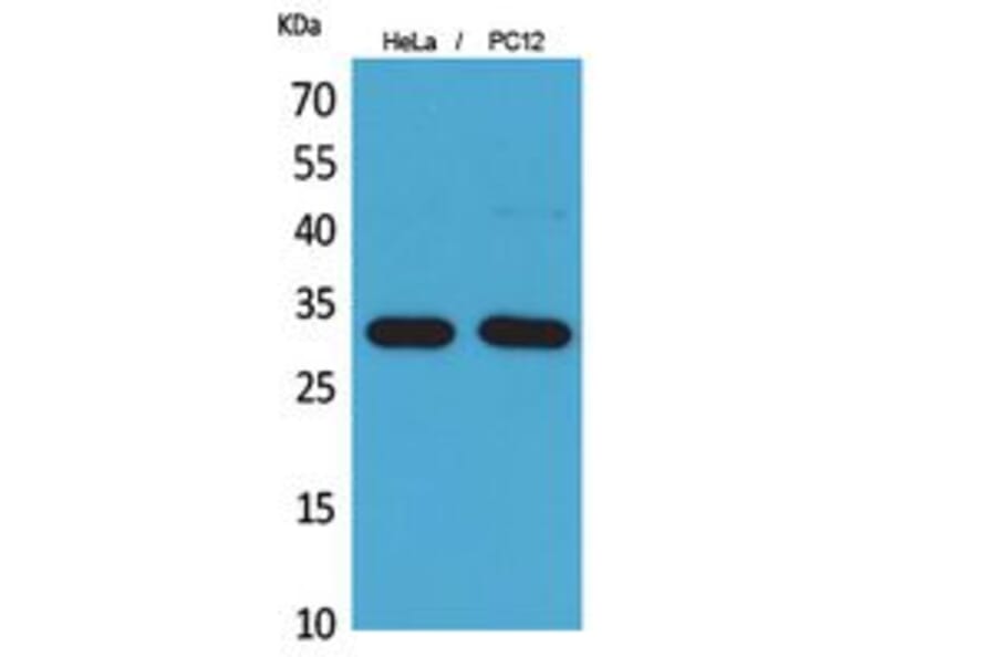 Western Blot - Anti-CD300LF Antibody (C30488) - Antibodies.com
