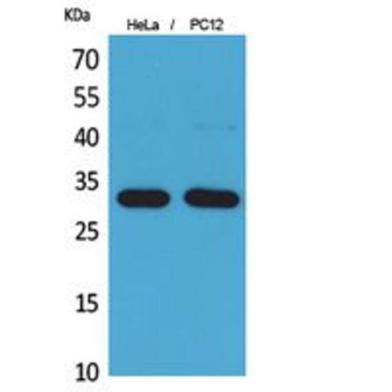 Western Blot - Anti-CD300LF Antibody (C30488) - Antibodies.com