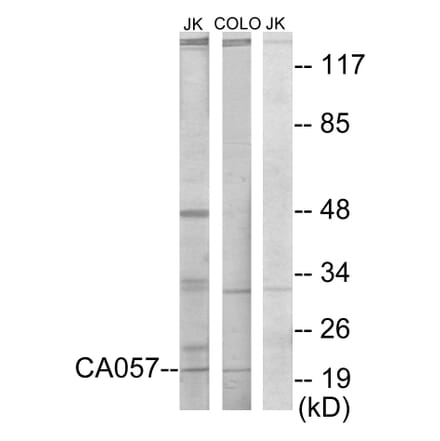 Western Blot - Anti-C1orf57 Antibody (C11606) - Antibodies.com