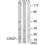 Western Blot - Anti-C1orf57 Antibody (C11606) - Antibodies.com