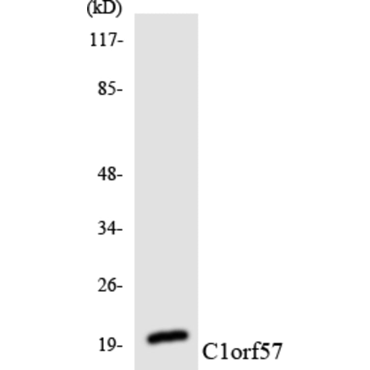 Western Blot - Anti-C1orf57 Antibody (R12-2551) - Antibodies.com