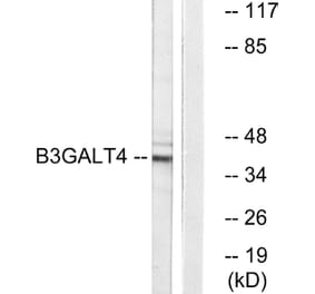 Western Blot - Anti-B3GALT4 Antibody (C14714) - Antibodies.com